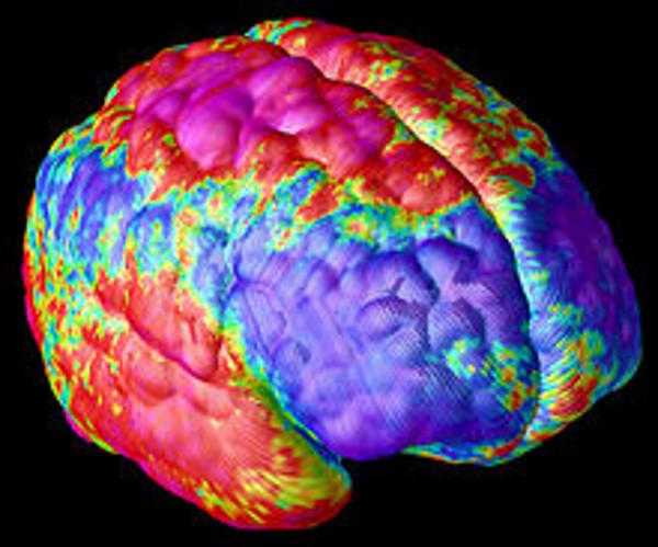 schizophrenia brain image