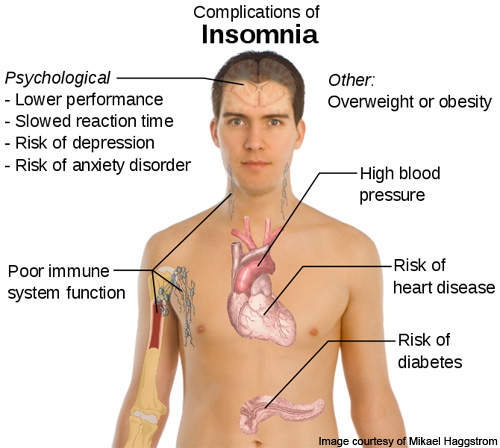 intermezzo-treatment-for-insomnia-drug-development-technology