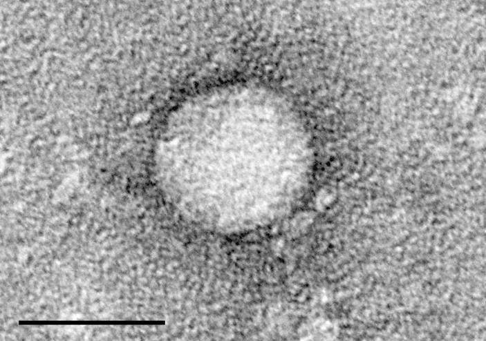 HCV EM picture