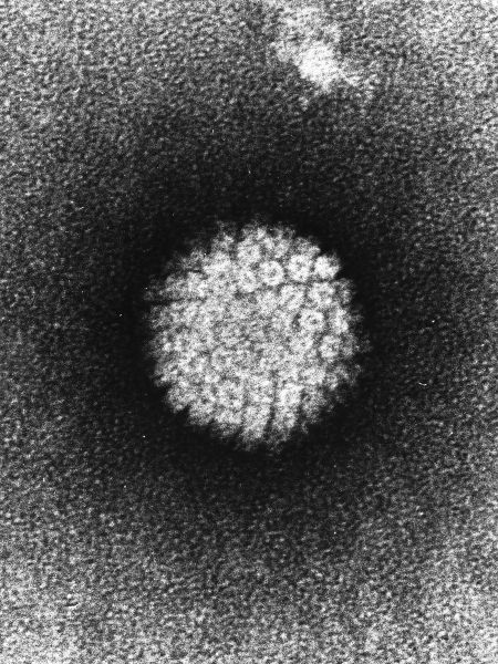 Advaxis HPV vaccine